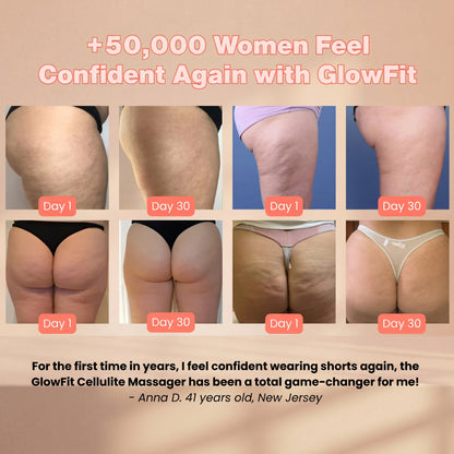 GLOWFIT  CELLULITE MASSAGER